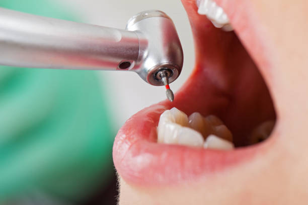 Best Emergency Broken Tooth Repair in Ravensworth, VA